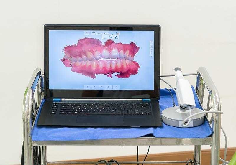 Анестезия без укола, «печать» коронок на 3D-принтере и другие новинки цифровой стоматологии