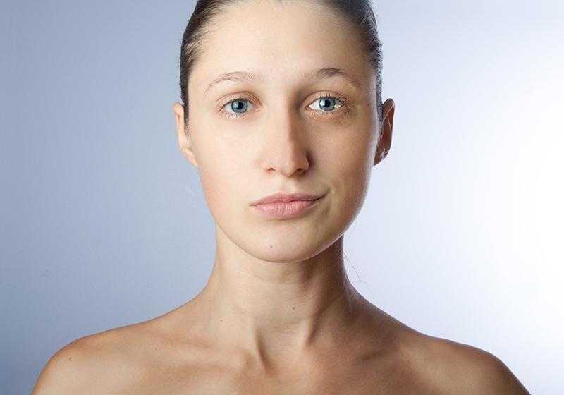 Отечность лица и еще 3 проблемы с внешностью, которые можно решить с помощью остеопатии
