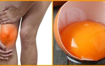 Как использовать 2 яйца для полного исчезновения боли в колени и «ремонта» суставов Колено…