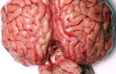 Головной мозг и мозжечок. Также видна часть спинного мозга