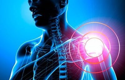 Современные представления о дифференциальной диагностике и лечении пациентов с болью в области плеча