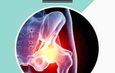 Транзиторный синовит тазобедренного сустава — это кратковременное неспецифическое воспаление оболочки тазобедренного сустава у детей,…