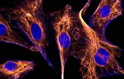 Микрофотография стволовых клеток мозга: