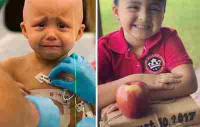 Малышка София победила рак. Разница между фото 3 года. С вами Медицинская Библиотека