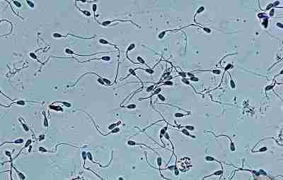 Сперматозоиды под микроскопoм: