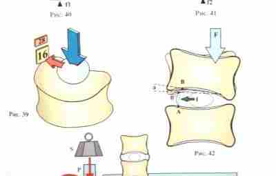 НАГРУЗКА НА МЕЖПОЗВОНКОВЫЙ ДИСК. Силы, действующие на межпозвонковый диск, увеличиваются по мере приближения к…