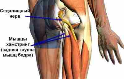 СИНДРОМ ИШИОКРУРАЛЬНЫХ МЫШЦ Болевой синдром в зоне задней группы мышц бедра (полусухожильная, полуперепончатая и…