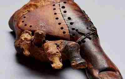 Стопа египетской мумии, которой около 3000 лет, обладает деревянным протезом большого пальца ноги. Это…