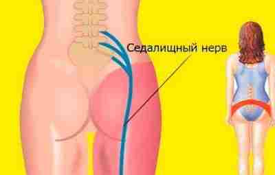 2 простых упражнения для разблокировки седалищного нерва. Самый крупный нерв в нашем теле седалищный,…