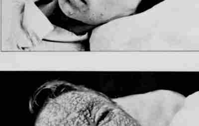 Черная оспа Последний случай заболевания черной оспой был зафиксирован в далеком 1977 году. Это…