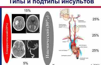 «Ранняя реабилитация больных, перенесших мозговой инсульт, в системе мультидисциплинарных бригад», Хабиров Ф.А. Казанская государственная…