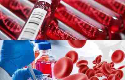 Гематоло́гия — раздел медицины, изучающий кровь, органы кроветворения, этиологию, диагностику, лечение, прогнозирование и предотвращение…