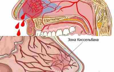 Сплетение Киссельбаха — это сосудистая сеть из четырех или пяти артерий в носу. Он…