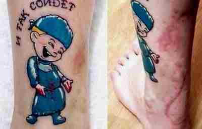 Парню неаккуратно зашили рану, и он решил сделать татуировку: