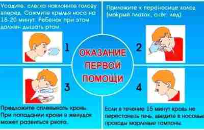 Носовое кровотечение. Первая помощь (подробная информация на рисунке) НЕЛЬЗЯ запрокидывать голову