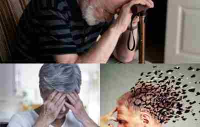 Болезнь Альцгеймера (также сенильная деменция альцгеймеровского типа) — наиболее распространённая форма деменции, нейродегенеративное заболевание,…
