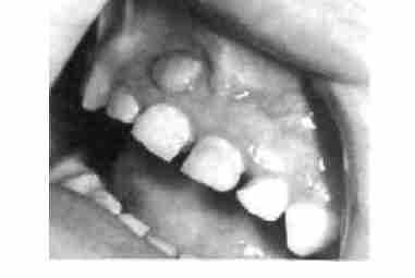 Опасный миф: молочные зубы нет смысла лечить Комментирует стоматолог-терапевт московской клиники…