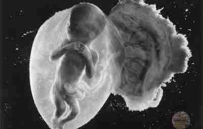 На фото эмбрион на 18-й неделе. И это не смоделированная, а реальная фотография. Ее…