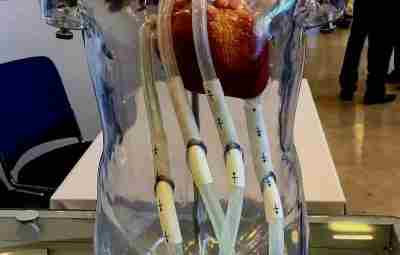 Модель искусственных желудочков детского сердца: