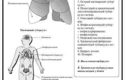 Заболевания дыхательной системы в схемах