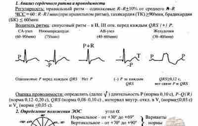 Отличная шпаргалка по ЭКГ