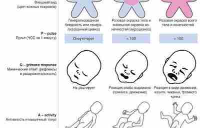 Оценка новорожденного по шкале Апгар