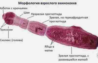 Эхинококкоз – разновидность глистной инвазии, возбудителем которой являются эхинококки, относящиеся к группе ленточных червей…