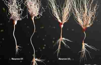 Такие разные и невероятно красивые нейроны головного мозга