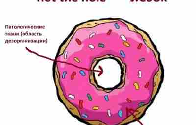 Treat the doughnut, not the hole. — , S. Docking et al. (2014) впервые…