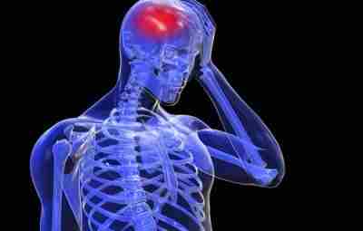 Сотрясение головного мозга Сотрясение головного мозга (СГМ) — наиболее легкий вид черепно-мозговой травмы (ЧМТ),…