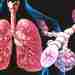 Рекомендации по занятиям физической культурой при бронхиальной астме Бронхиальная астма не является противопоказанием к…