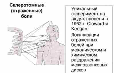 СКЛЕРОТОМНЫЕ БОЛИ. Механизм распространения болей по склеротомам и их морфологические предпосылки изучены недостаточно, несмотря…