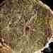 Цветная микрофотография спинномозгового нерва человека: