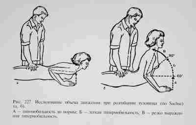 ИССЛЕДОВАНИЕ КОНСТИТУЦИОНАЛЬНОЙ ГИПЕРМОБИЛЬНОСТИ. К.Левит, «Мануальная медицина». Термин «гипермобильность» охватывает очень различные состояния с точки…