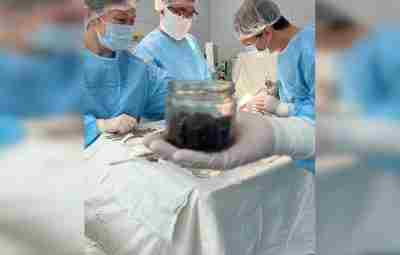 В Башкирии хирурги извлекли 300 граммов магнитов из желудка пациента — ими по рецепту…