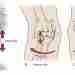 Повреждения связок локтевого сустава Клинически значимая анатомия Локтевой сустав стабилизируется тремя связками: Локтевая коллатеральная…