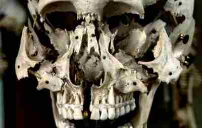22 кости, из которых состоит человеческий череп: