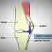 Боль в переднем отделе колена является сложной проблемой для диагностики с множественной этиологией. Системный…
