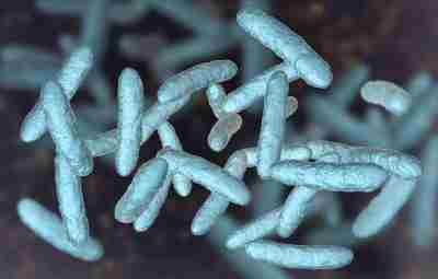 Могут ли кишечные бактерии бороться со старостью? https://m.vk.com/@archiv_kachka-mogut-li-kishechnye-bakterii-borotsya-so-starostu Article