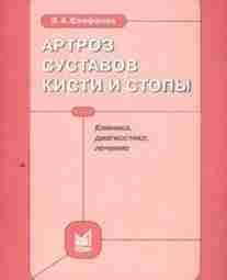 Артроз суставов кисти и стопы — Епифанов В.А. — Клиника, диагностика, лечение Описание: Монография…