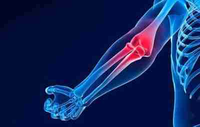 Травмы локтевого сустава Для спортсменов, занимающихся пауэрлифтингом и бодибилдингом, локтевые суставы являются наиболее уязвимым…