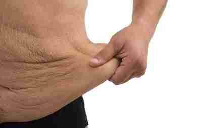 Почему кожа обвисает? быстрое похудение – при значительной потере веса ткани не успевают адаптироваться,…
