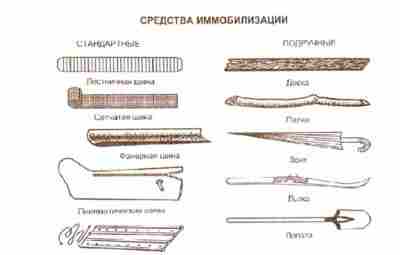 ОСНОВНОЕ СРЕДСТВО ИММОБИЛИЗАЦИИ ПОВРЕЖДЁННОЙ КОНЕЧНОСТИ НА ПЕРИОД ТРАНСПОРТИРОВКИ ПОСТРАДАВШЕГО. Транспортная иммобилизация при тяжелых травмах…