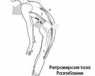 Ретроверсия таза — наклон таза назад. К чему ведет живот…