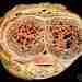 Поперечные срезы полового члена На фото видны: пещеристое тело, губчатое тело и мочевой канал