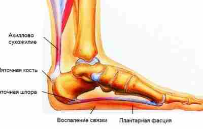 ПАТОЛОГИЯ МЯГКИХ ТКАНЕЙ ОБЛАСТИ ГОЛЕНОСТОПНОГО СУСТАВА И СТОПЫ –…