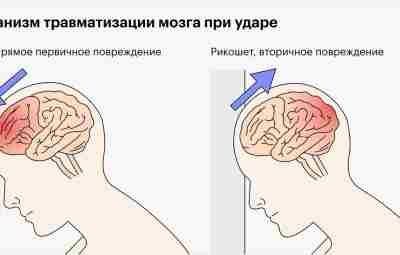 Ранний выход в школу облегчил симптомы сотрясения мозга у детей и подростков. Особенно тех,…