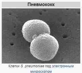 #вакцинация Вновь о необходимости вакцинации против пневмококковой инфекции. Пневмотекс — новая вакцина в РФ…