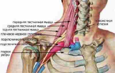 Синдром Передней лестничной мышцы или синдром Наффцигера. https://m.vk.com/@med_sport-sindrom-perednei-lestnichnoi-myshcy-ili-sindrom-naffcigera Article