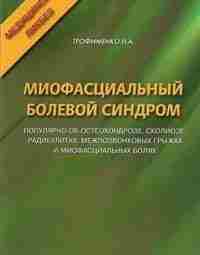 Миофасциальный болевой синдром — Трофименко Н.А